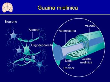 Guaina mielinica