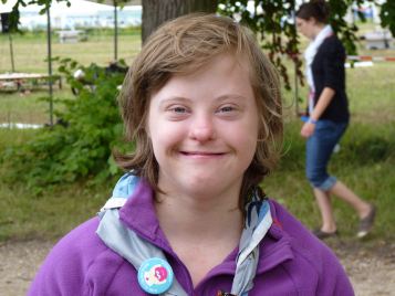 Giovane donna con sindrome di Down