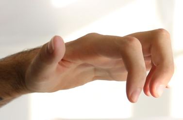 Apertura della mano da parte della persona sottoposta all'intervento di trasposizione nervosa (o neurotizzazione)