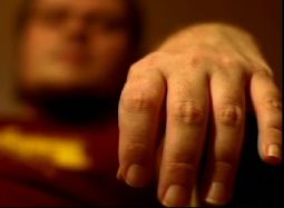 Primo piano di mano di persona con sclerosi laterale amiotrofica. Sullo sfondo, sfuocato, il volto
