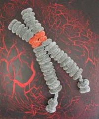 La sindrome dell'X-fragile prende il nome dal sito «fragile» del cromosoma X che appare, dagli studi di laboratorio, come «rotto»