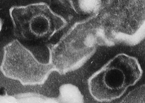 Virus di Epstein-Barr osservato al microscopio