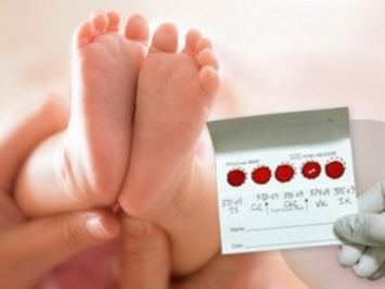 Screening neonatale su piedini del neonato