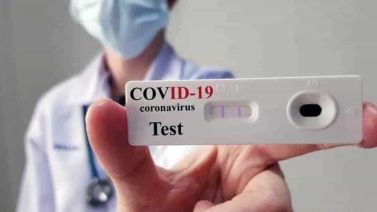 Operatore sanitario tiene in mano un test sierologico per coronavirus