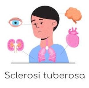 Disegno dedicato alla sclerosi tuberosa