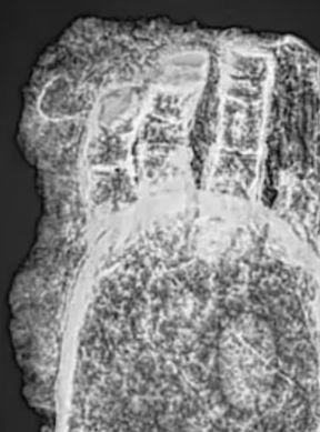 Radiografia della mano in ferro di Frisinga