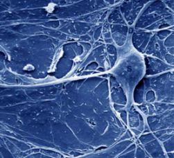 Neurone con assone (il filamento orizzontale a sinistra) e dendriti