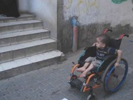 Bimbo con disabilità a Gaza, in Palestina